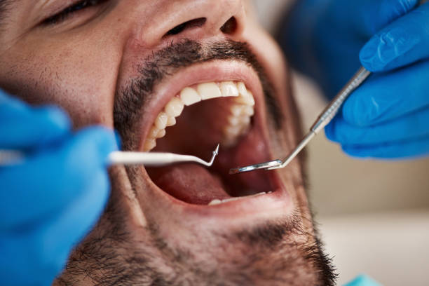 Best Pediatric Emergency Dentist in Dover, TN